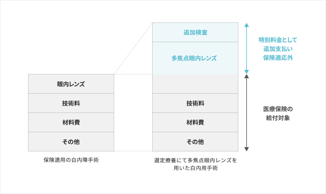 選定療養対象の多焦点眼内レンズの場合