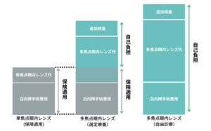 選定療養による白内障手術